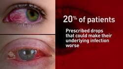 Antibiotics may not be the answer to pink eye News Clip