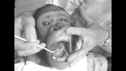 Bucky, a four year old chimp, gets upper plate dentures at Hollywood dentist's office News Clip