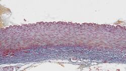 Arteries and veins histology Instructional Video