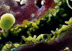 Bile Instructional Video