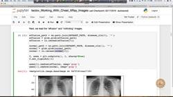 Evaluate the impact of an AI application used in the real world. (case study) : Working with X-Ray images: Case Study - Part 1 Instructional Video