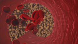 The Health Benefits of Teff Instructional Video