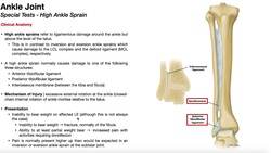 High Ankle Sprains | Anatomy, Presentation, Diagnosis, & Treatment Basics Instructional Video