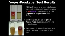 Microbiology: Voges-Proskauer Test Instructional Video