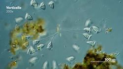 Flinching Saves Lives in the Microcosmos Instructional Video