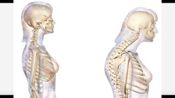 THEORY | Subacromial Impingement Instructional Video