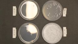 The Importance of Calcium: Building Strong Bones and More Instructional Video