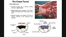 Anatomy & Structures in the Carpal Tunnel Instructional Video