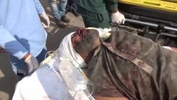 CLEAN : Victim of deadly Pakistan train blaze in transit for treatment News Clip