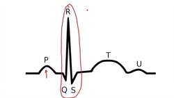 How to Read an Electrocardiogram (ECG/EKG) Instructional Video