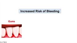 Low Platelets: Signs & Symptoms (Basics for Beginners) Instructional Video