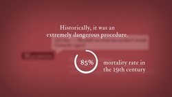 Macbeth 5.7 Historical Reference: Caesarian Delivery Instructional Video