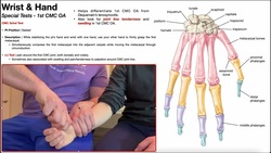 CMC Grind Test (for First CMC Joint Osteoarthritis) Instructional Video