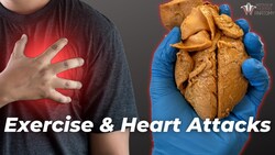 Can Exercise Prevent Heart Attacks? Instructional Video