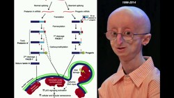 Progeria, Accelerated Aging | Biochemical Mechanism of Progeria Instructional Video