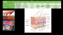 Classifying Burns EXPLAINED Instructional Video