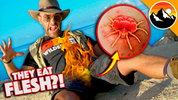 Bitten by Chiggers! Great Balls of FIRE! Instructional Video