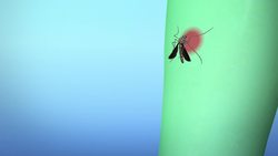 Brain-infecting virus being spread by mosquitoes in Florida Instructional Video