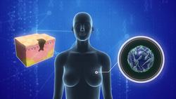 Flight attendants linked to higher rates of cancer Instructional Video