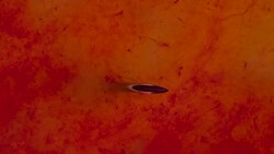 Introduction of Injection Intramuscularly Stock Footage