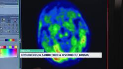 Updated federal regulations will make opioid drug treatments more accessible News Clip