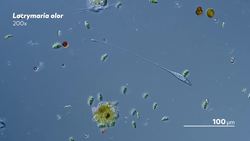 Lacrymaria: Vicious Long-Necked Predators Instructional Video