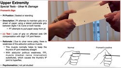 Froment's Sign | Rationale & Interpretation Instructional Video