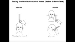 Interpreting the Weber-Rinne Tests EXPLAINED Instructional Video