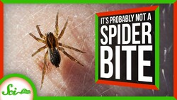 That’s Probably Not a Spider Bite Instructional Video