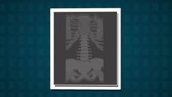 How Does it Work? - X-rays Instructional Video