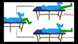The Thomas Test | Interpretation of Results Instructional Video