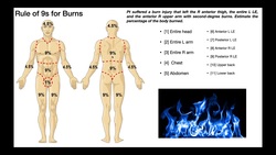 The Rule of 9s 🔥 | Estimating Burn Surface Area Instructional Video