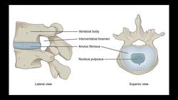 Cervical Radiculopathy Mechanism Chemical Nerve Root Irritation Instructional Video