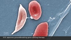 U.K. approves world's first gene therapy treatment for sickle cell News Clip