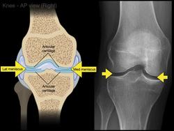 Anatomy of Knee X-rays Instructional Video