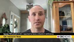 Nearly 700 people in B.C. reported to have a vitamin C deficiency News Clip