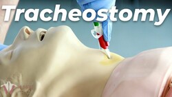 Understanding Tracheostomy: Anatomy and Procedure Instructional Video