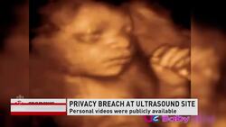 Ultrasound video service shut down due to security lapse News Clip