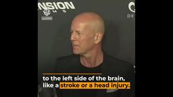 US actor Bruce Willis ‘retires’: What is aphasia? News Clip