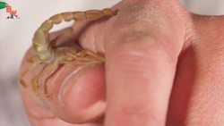 My Secret Sting Antidote! Instructional Video