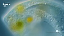 Bursaria: Giant Gravity-Sensing Vacuums Instructional Video