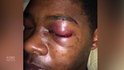 Toronto police officer gets 9-month jail sentence for Dafonte Miller assault News Clip