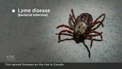Woman dies from tick-borne virus as dangerous illnesses spread Instructional Video
