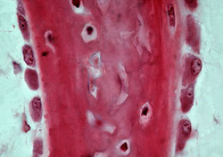 Osteocyte Instructional Video