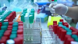 Scientist and bio lab experiment Stock Footage