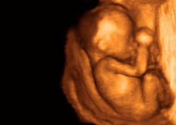 Foetus Instructional Video