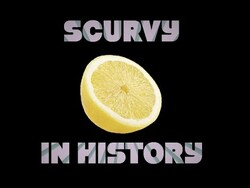 Scurvy and World History Explained Instructional Video
