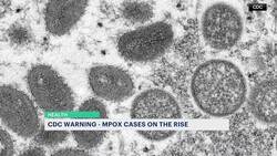 CDC urges people to get vaccinated amid resurgence of mpox News Clip