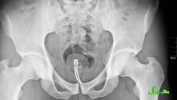 6 Surprising Blood-Drinking Animals Instructional Video