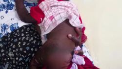 Graphic warning: Sudan accused of using chemical weapons against civillians News Clip